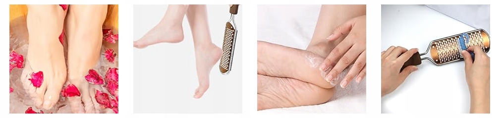 PROFESJONALNY PILNIK DO STÓP|USUWANIE ZROGOWACIAŁEJ SKÓRY| STAL NIERDZEWNA - obrazek 11