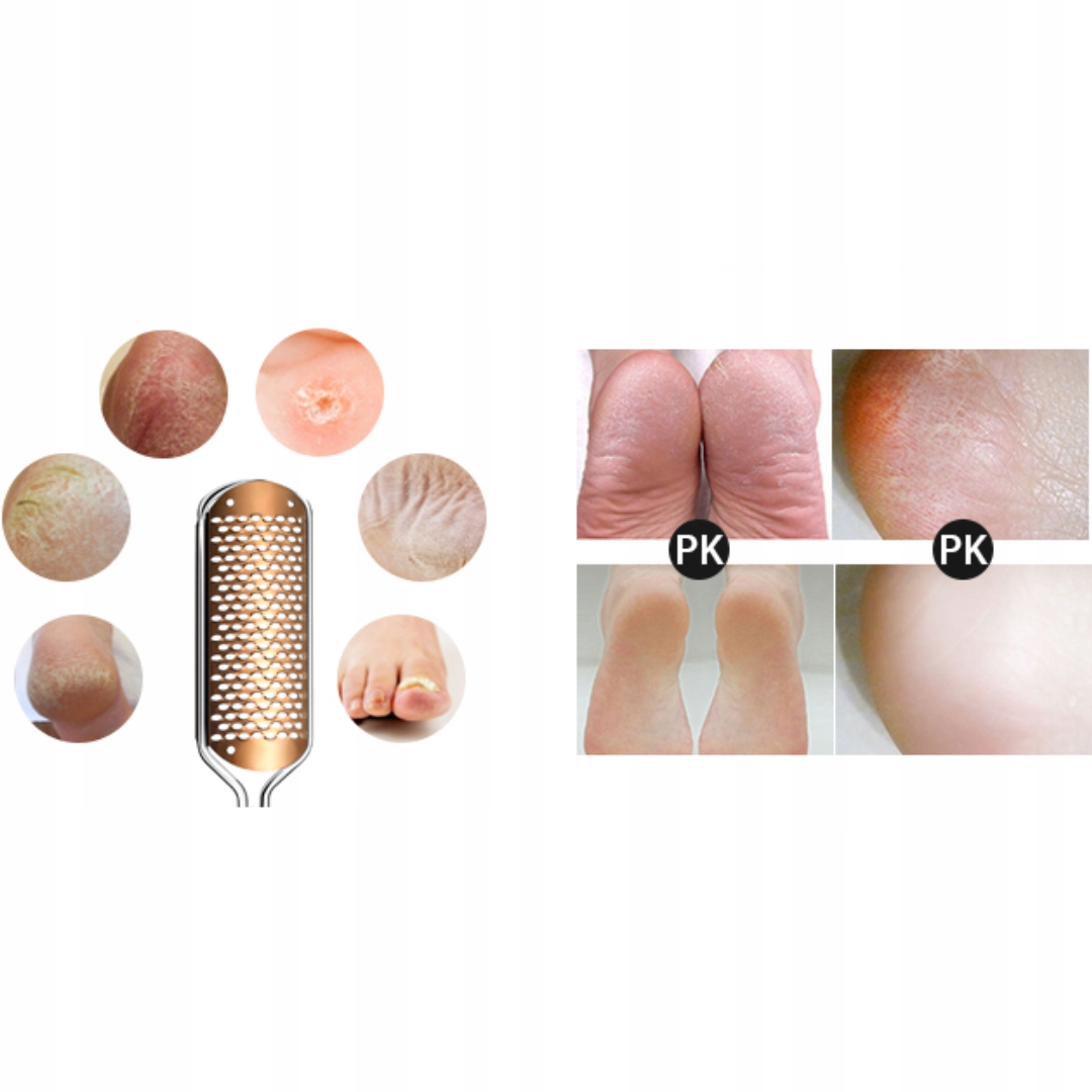 PROFESJONALNY PILNIK DO STÓP|USUWANIE ZROGOWACIAŁEJ SKÓRY| STAL NIERDZEWNA - obrazek 10