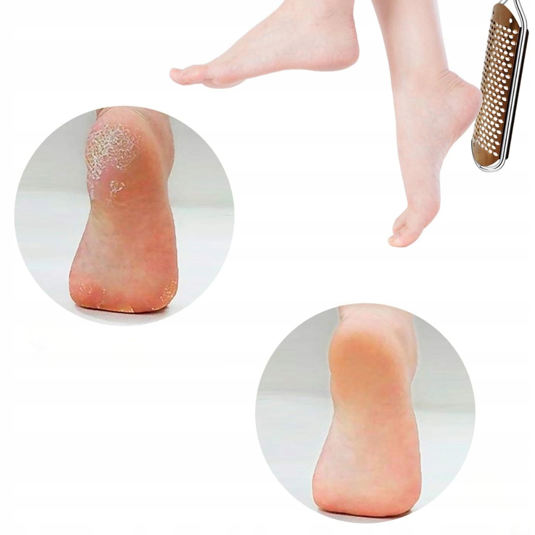 PROFESJONALNY PILNIK DO STÓP|USUWANIE ZROGOWACIAŁEJ SKÓRY| STAL NIERDZEWNA - obrazek 3