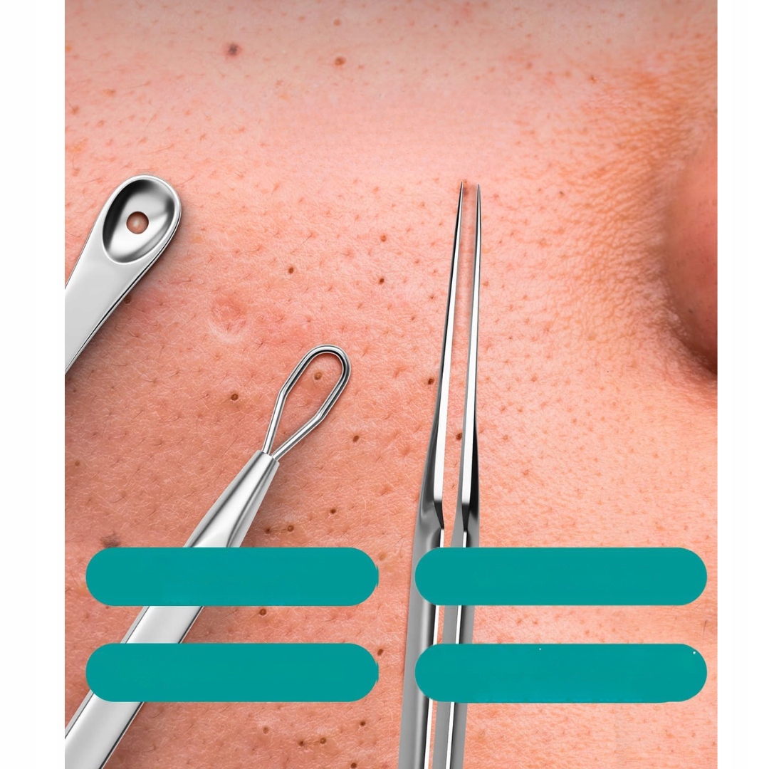 Zestaw do Usuwania Zaskórników 7Szt Wyciskanie Pryszczy Wągrów Stal - obrazek 2